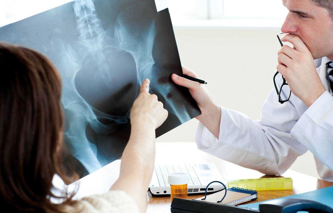 shifokorlar kestirib, artroz uchun rentgenogrammani tekshiradi